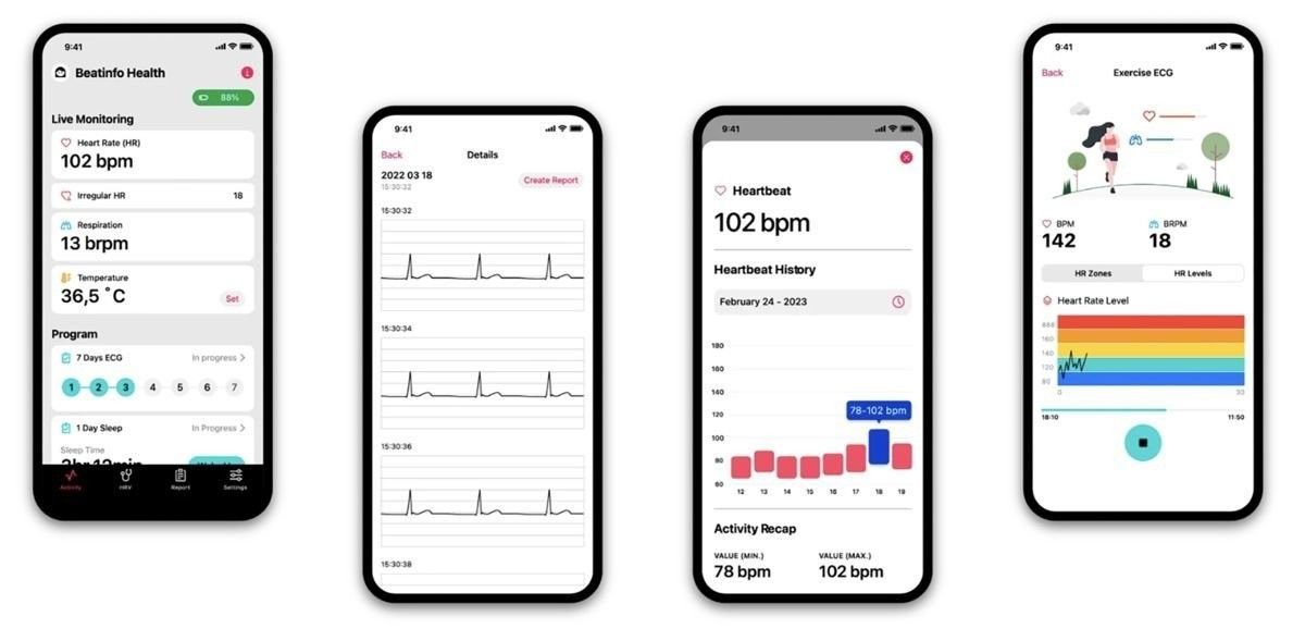 beatinfo-cgm-2.jpg